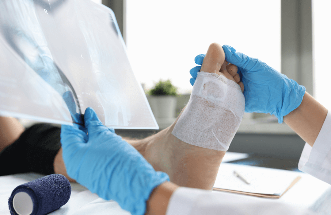 Doctor examining foot injury with bandage and X-ray, illustrating injuries not covered under Pennsylvania workers’ compensation claims.